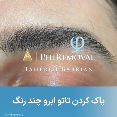 پاک کردن تاتو های بژ رنگ سفید رنگ و کامو در یک جلسه هنر دست خواهران ببریان