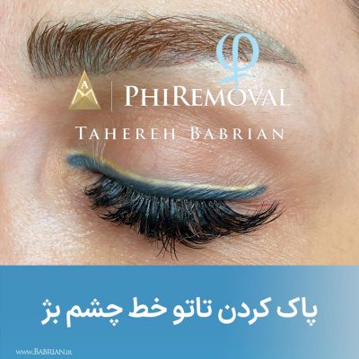 پاک کردن تاتو و رشد مجدد موهای ابرو با خواهران ببریان
