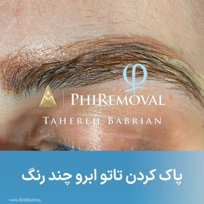 پاک کردن تاتو های بژ رنگ سفید رنگ و کامو در یک جلسه هنر دست خواهران ببریان