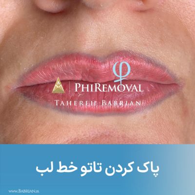 پاک کردن تاتو و رشد مجدد موهای ابرو با خواهران ببریان