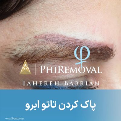 ریموو تاتو ابرو بدن لب خط چشم با خواهران ببریان